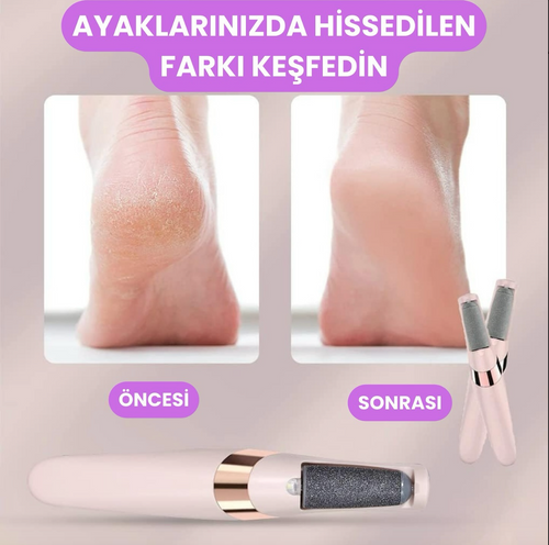 Şarjlı Topuk ve Nasır Temizleyici