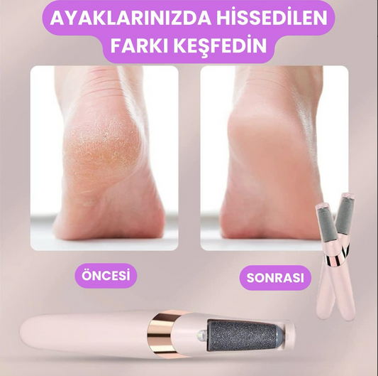 Şarjlı Topuk ve Nasır Temizleyici